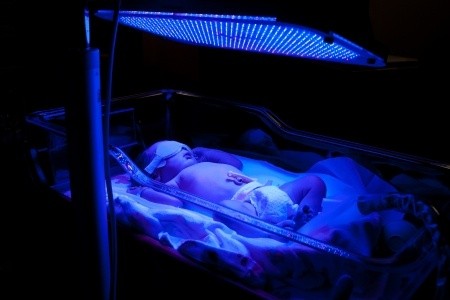 Baby mit hohen Bilirubin-Werten liegt im Bilibed