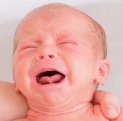 Schreiendes Baby mit verkürztem Zungenbändchen