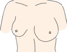 asymmetrische Brüste (Zeichnung)