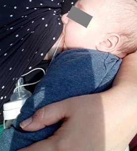 Mutter füttert Baby mit Sonde zu